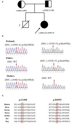Oculogyric crisis mimicked epilepsy in a Chinese aromatic L-amino acid decarboxylase-deficiency patient: A case report